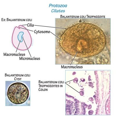  Balantidium Ciliatü: Gizemli Bir Mikrokozmos Yaratığı!