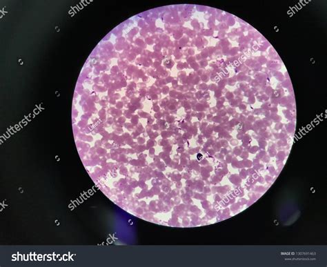  Trypanosoma: Bir Hücresel Savaşçı mı? Hayvan Krallığının Gizli Kahramanlarına Odaklanarak Mikroskobik Dünyayı Keşfedin!